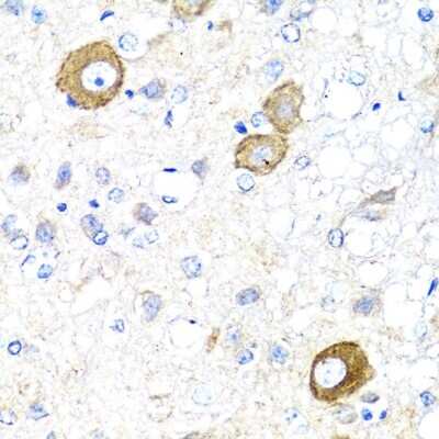 Immunohistochemistry-Paraffin: NRG4 Antibody - Azide and BSA Free [NBP2-93954]