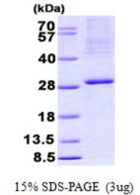 SDS-PAGE: Recombinant Human NRIF3 His Protein [NBP2-23143]