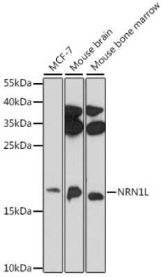 Western Blot: NRN1L AntibodyAzide and BSA Free [NBP2-94688]