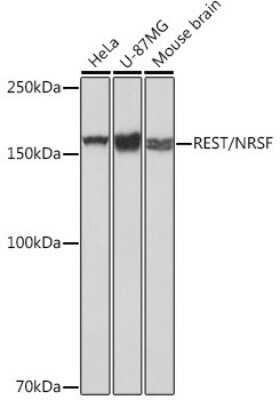 Western Blot: NRSF Antibody (8R8Z4) [NBP3-16128]