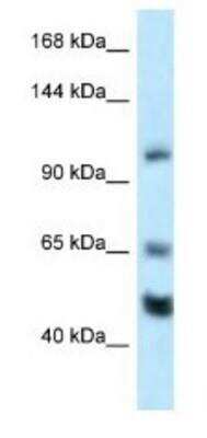 Western Blot: NRSF Antibody [NBP1-82399]