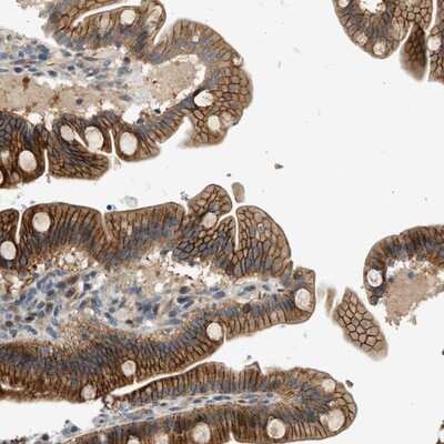 Immunohistochemistry-Paraffin: NRSN2 Antibody [NBP1-88290]