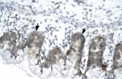 Immunohistochemistry: NS1-BP Antibody [NBP2-85403]