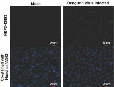 Immunocytochemistry/ Immunofluorescence: Dengue Virus NS3 Antibody [NBP2-42893]