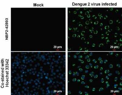 Immunocytochemistry/ Immunofluorescence: Dengue Virus NS3 Antibody [NBP2-42893]