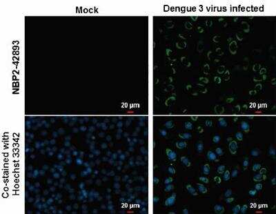 Immunocytochemistry/ Immunofluorescence: Dengue Virus NS3 Antibody [NBP2-42893]