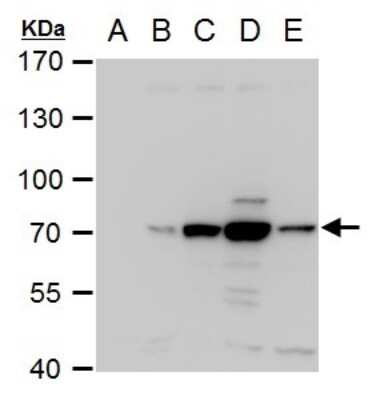 Western Blot: Dengue Virus NS3 Antibody [NBP2-42893]