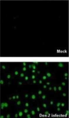 Immunocytochemistry/ Immunofluorescence: Dengue Virus NS5 Antibody [NBP2-42900]