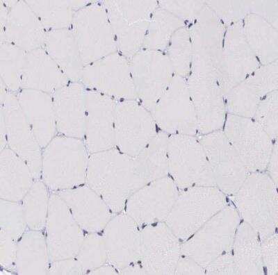 Immunohistochemistry-Paraffin: NSBP1 Antibody [NBP1-87379]