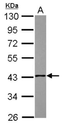 Western Blot: NSDHL Antibody [NBP2-19590]
