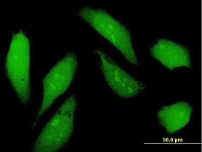 Immunocytochemistry/ Immunofluorescence: NSFL1C Antibody [H00055968-B01P]