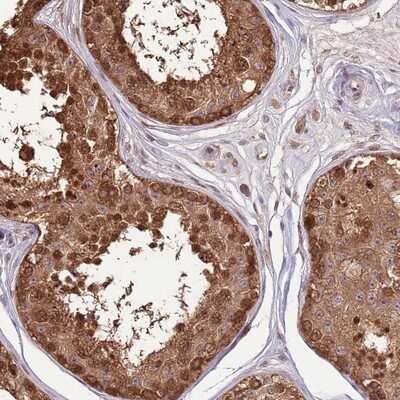 Immunohistochemistry-Paraffin: NSFL1C Antibody [NBP2-13676]