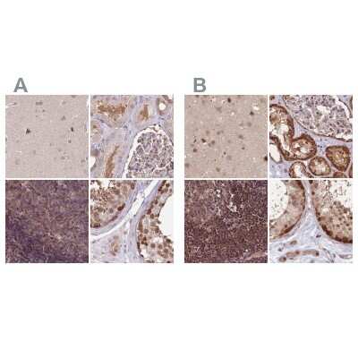 Immunohistochemistry-Paraffin: NSFL1C Antibody [NBP2-13676]