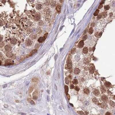 Immunohistochemistry-Paraffin: NSFL1C Antibody [NBP2-13676]
