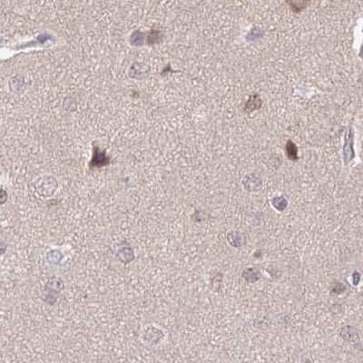 Immunohistochemistry-Paraffin: NSFL1C Antibody [NBP2-13676]