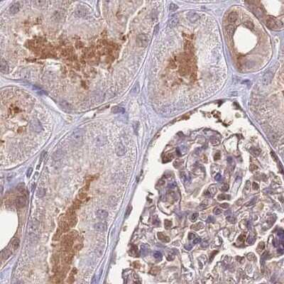Immunohistochemistry-Paraffin: NSFL1C Antibody [NBP2-13676]