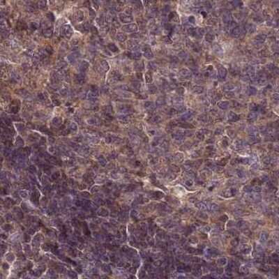 Immunohistochemistry-Paraffin: NSFL1C Antibody [NBP2-13676]