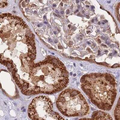 Immunohistochemistry-Paraffin: NSFL1C Antibody [NBP2-13677]