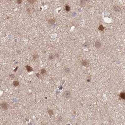 Immunohistochemistry-Paraffin: NSFL1C Antibody [NBP2-13677]