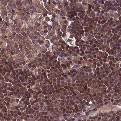 Immunohistochemistry-Paraffin: NSFL1C Antibody [NBP2-13677]