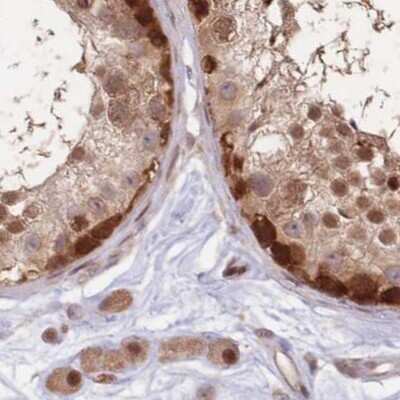 Immunohistochemistry-Paraffin: NSFL1C Antibody [NBP2-13677]