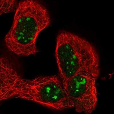 Immunocytochemistry/ Immunofluorescence: NSMAF Antibody [NBP1-84735]