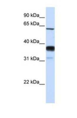 Western Blot: SMPD3/NSMase2 Antibody [NBP1-69344]