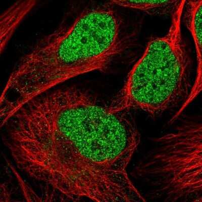 Immunocytochemistry/ Immunofluorescence: NSMCE4A Antibody [NBP1-90789]