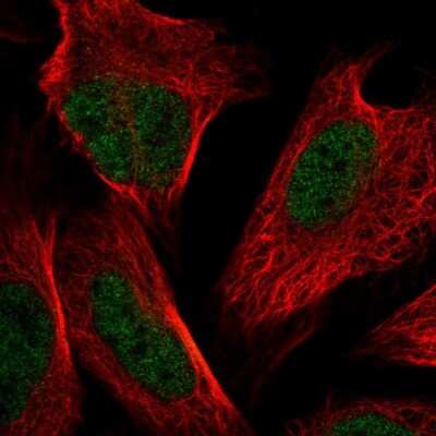 Immunocytochemistry/ Immunofluorescence: NSMCE4A Antibody [NBP2-55189]