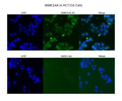 Immunocytochemistry/ Immunofluorescence: NSMCE4A Antibody [NBP2-87945]