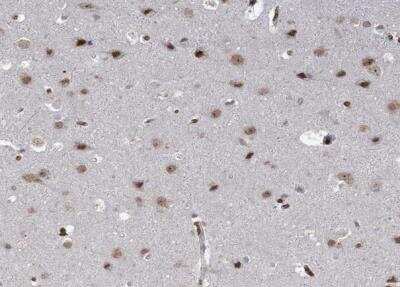 Immunohistochemistry-Paraffin: NSMCE4A Antibody [NBP1-90789]