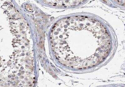 Immunohistochemistry-Paraffin: NSMCE4A Antibody [NBP1-90789]