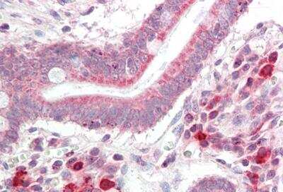 Immunohistochemistry-Paraffin: NSMCE4A Antibody [NBP2-87946]