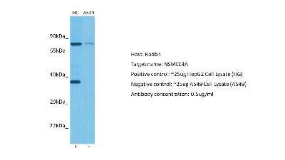 Western Blot: NSMCE4A Antibody [NBP2-87945]