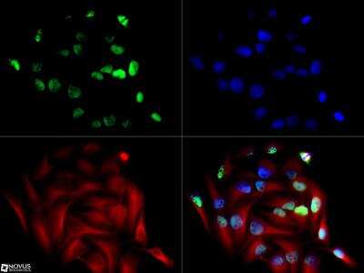 Immunocytochemistry/ Immunofluorescence: NSP 5 alpha 3 alpha Antibody [NB100-517]