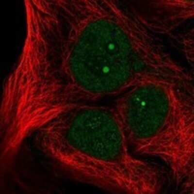 Immunocytochemistry/ Immunofluorescence: NSP 5 alpha 3 alpha Antibody [NBP3-17187]