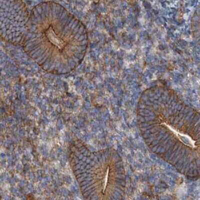 Immunohistochemistry-Paraffin: NSP 5 alpha 3 alpha Antibody [NBP1-85353]