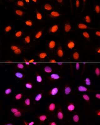 Immunocytochemistry/ Immunofluorescence: NSUN2 Antibody - BSA Free [NBP2-94855]