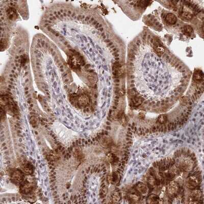 Immunohistochemistry-Paraffin: NSUN2 Antibody [NBP1-82189]
