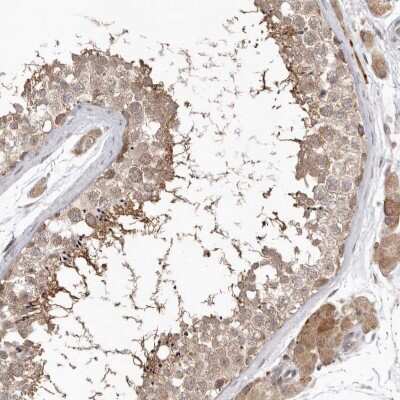 Immunohistochemistry-Paraffin: NSUN4 Antibody [NBP1-82733]