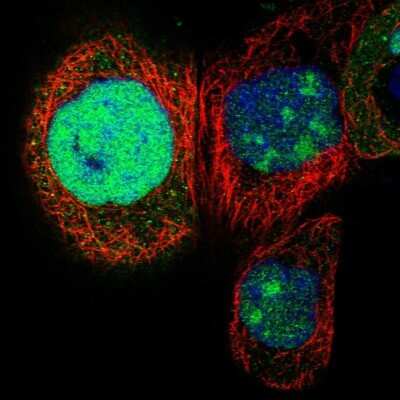 Immunocytochemistry/ Immunofluorescence: NSUN5 Antibody [NBP1-89416]