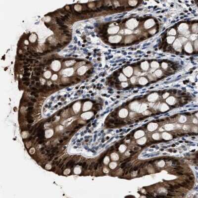 Immunohistochemistry-Paraffin: NSUN5 Antibody [NBP1-89416]