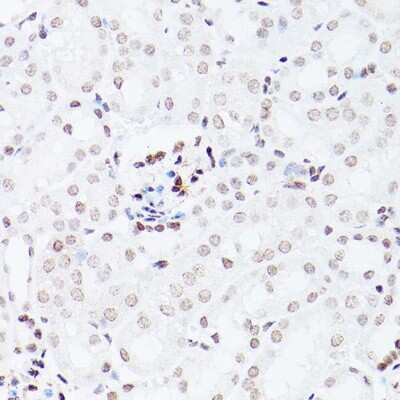 Immunohistochemistry-Paraffin: NSUN5 Antibody - Azide and BSA Free [NBP3-16628]