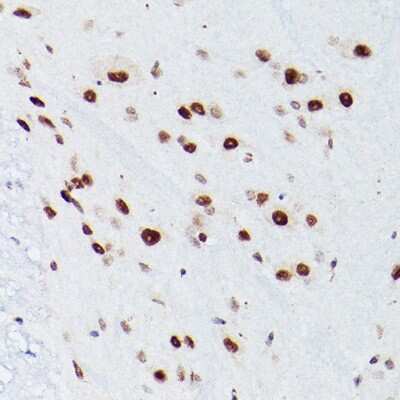 Immunohistochemistry-Paraffin: NSUN5 Antibody - Azide and BSA Free [NBP3-16628]