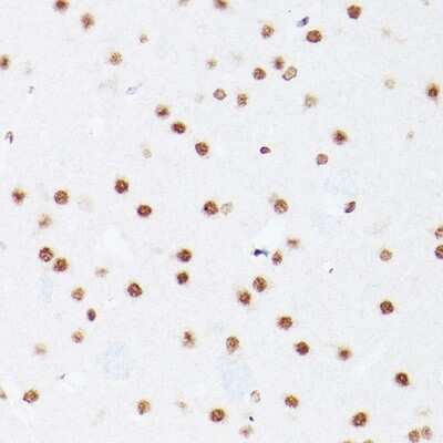 Immunohistochemistry-Paraffin: NSUN5 Antibody - Azide and BSA Free [NBP3-16628]