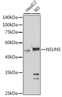 Western Blot: NSUN5 AntibodyAzide and BSA Free [NBP3-16628]