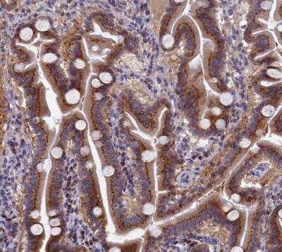 Immunohistochemistry-Paraffin: NSUN6 Antibody [NBP1-92202]