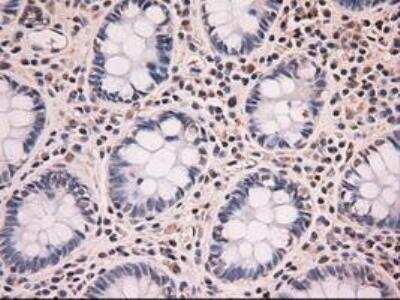 Immunohistochemistry-Paraffin: NT-4 Antibody (OTI2E8) [NBP1-47897]
