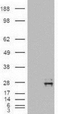 Western Blot: NT-4 Antibody (OTI2E8)Azide and BSA Free [NBP2-73072]