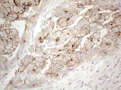 Immunohistochemistry: NT-proBNP Antibody (OTI11G4) - Azide and BSA Free [NBP2-71213]